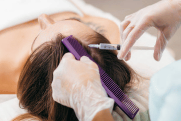 Hair Loss Treatments - Eryna Aesthetic Clinic in KL